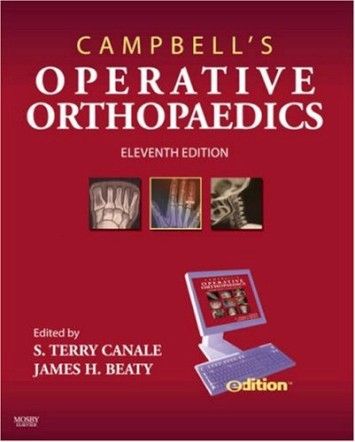 Campbell's Operative Orthopaedics, 11th edition Campbell's Operative Orthopaedics, 11th edition