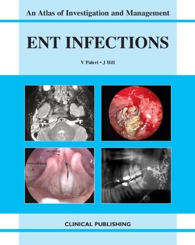 ENT Infections: An Atlas of Investigation and Management (repost) ENT Infections: An Atlas of Investigation and Management (repost)